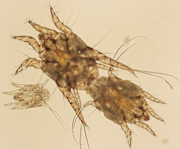 Microscope de laboratoire avec caméra vidéo